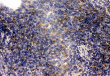 Anti-CD23/FCER2 Antibody