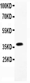Anti-CD23/FCER2 Antibody