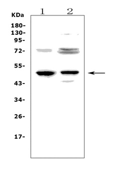 Anti-CD23/FCER2 Antibody
