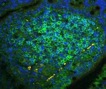 Anti-CD23/FCER2 Antibody