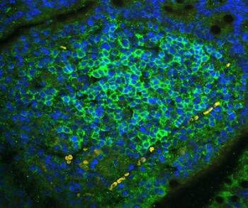 CD23/FCER2 Antibody