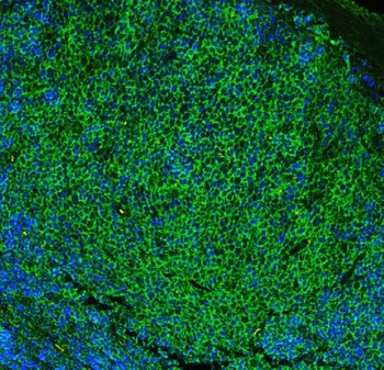 Anti-CD23/FCER2 Antibody