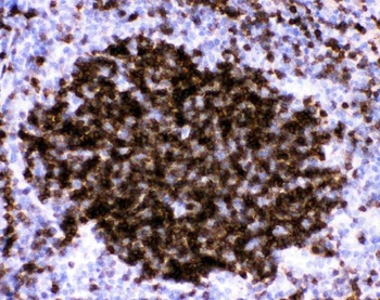 CD23/FCER2 Antibody