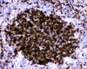 Anti-CD23/FCER2 Antibody