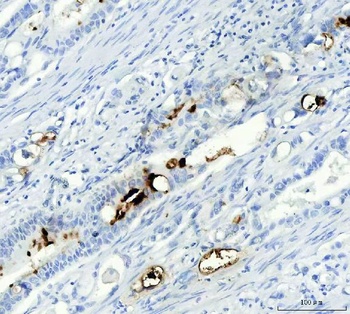 Mucin Gastric MUC5AC Antibody (Monoclonal, 45M1)
