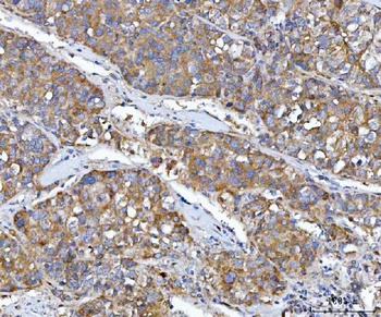 Src Rabbit Polyclonal Antibody