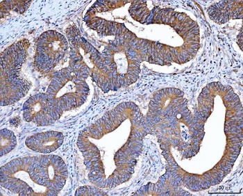 Src Rabbit Polyclonal Antibody