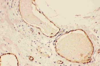 Anti-Von Willebrand Factor/VWF Antibody