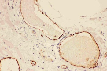 Von Willebrand Factor/VWF Antibody