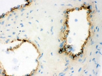 Anti-Von Willebrand Factor/VWF Antibody