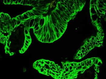 Anti-Pan cytokeratin Antibody (Monoclonal, PCK-26)