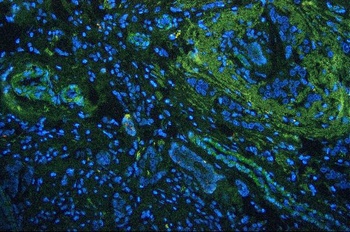 Anti-Vinculin VCL Antibody (Monoclonal, hVIN-1)