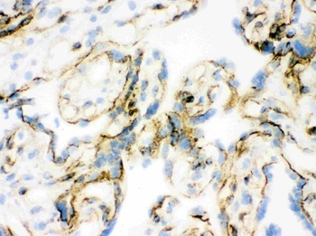 Anti-Vinculin VCL Antibody (Monoclonal, hVIN-1)