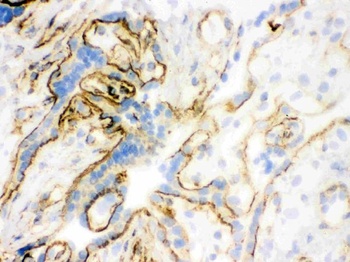 Vinculin VCL Antibody (Monoclonal, hVIN-1)