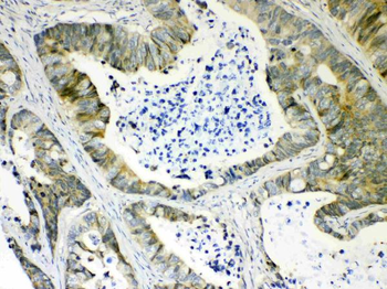 Anti-AKR1B10 Antibody