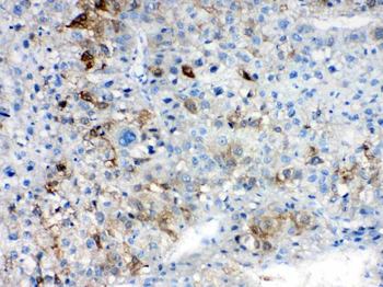 Anti-AKR1B10 Antibody