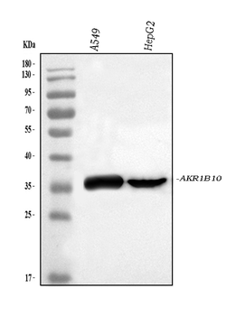 Anti-AKR1B10 Antibody