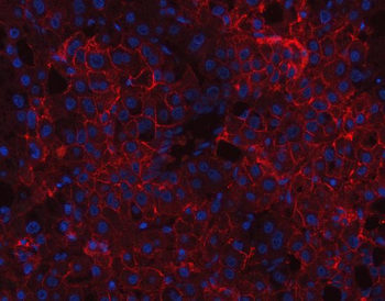 Anti-CD166/ALCAM Antibody