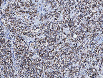 Anti-CD166/ALCAM Antibody