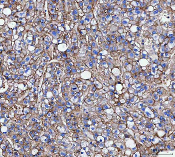 Anti-CD166/ALCAM Antibody