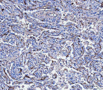 Anti-CD166/ALCAM Antibody