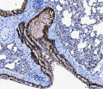 Anti-CD166/ALCAM Antibody