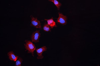 Anti-ALDH1A3 Antibody