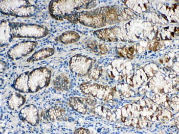 Anti-ALDH1A3 Antibody