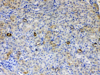 Anti-ALDH1A3 Antibody