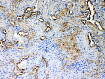 Anti-ALDH1A3 Antibody