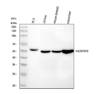 Anti-ALDH1A3 Antibody