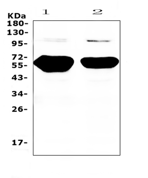 Anti-Amylase/AMY1A/AMY1B/AMY1C Antibody