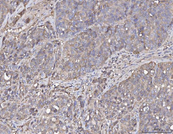 Anti-Annexin IV/ANXA4 Antibody