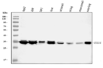 Anti-Annexin IV/ANXA4 Antibody