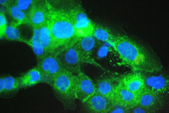 Anti-Beta 2 Microglobulin/B2M Antibody
