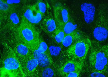 Anti-Beta 2 Microglobulin/B2M Antibody