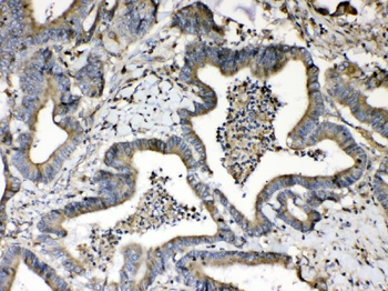 Anti-Beta 2 Microglobulin/B2M Antibody