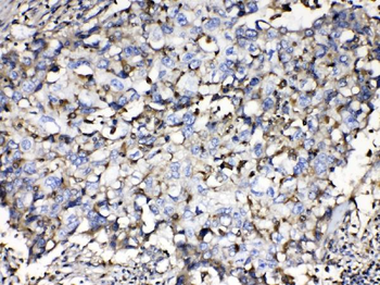 Anti-Beta 2 Microglobulin/B2M Antibody