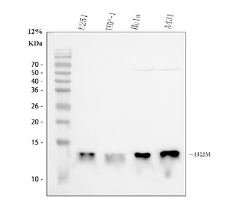 Anti-Beta 2 Microglobulin/B2M Antibody