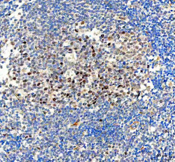 Anti-Bag1 Antibody