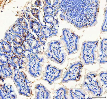 Anti-Bag1 Antibody