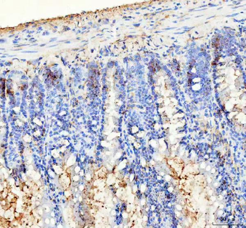Anti-Bag1 Antibody