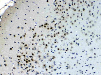 Anti-Choline Acetyltransferase/CHAT Antibody