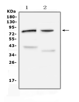 Anti-Choline Acetyltransferase/CHAT Antibody