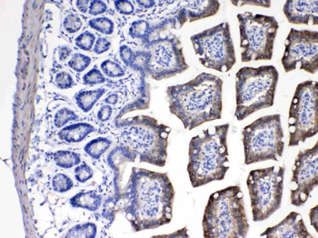 Anti-Cytochrome P450 2D6/CYP2D6 Antibody