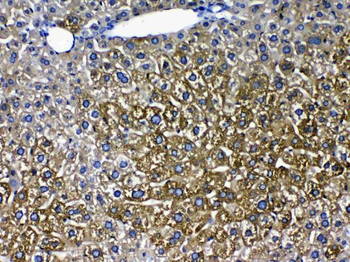 Anti-Cytochrome P450 2D6/CYP2D6 Antibody