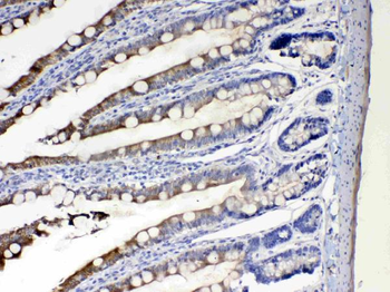 Anti-Cytochrome P450 2D6/CYP2D6 Antibody