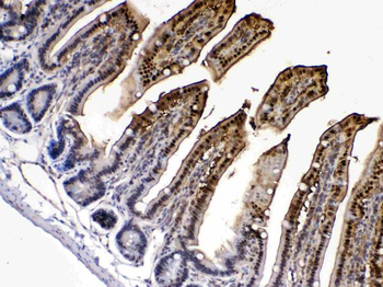 Anti-FABP2/I-FABP Antibody