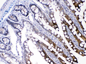Anti-FABP2/I-FABP Antibody