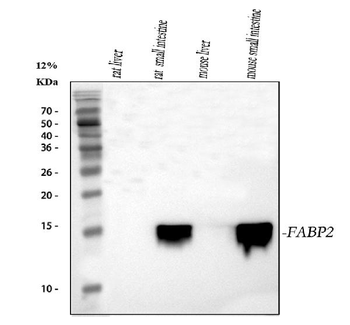 Anti-FABP2/I-FABP Antibody